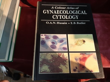 170 A Colour Atlas of Gynecologic Cytopathology