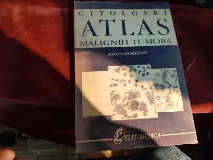 170 Citološki atlas malignih tumora - Milica Đorđević