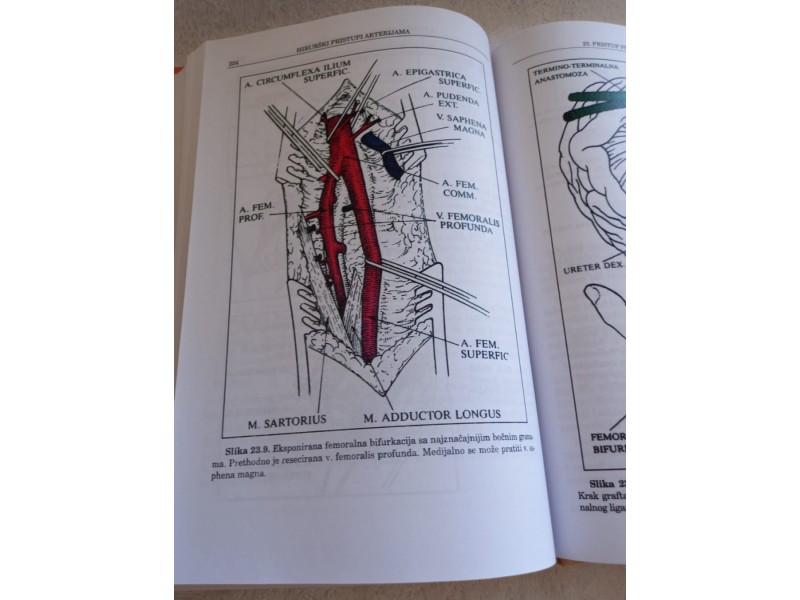 Hirurški pristupi arterijama,Đorđe Radak