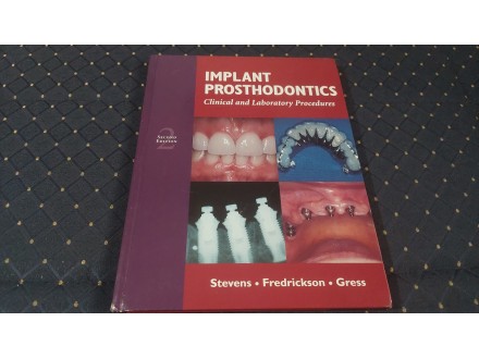 Implant Prosthodontics/Stevens,Frederickson,Gress